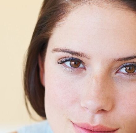 5 preconcetti sulla forfora